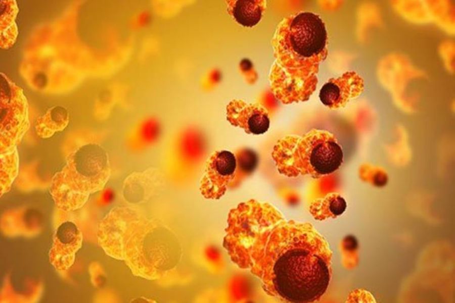 Fatty Acid May Kill Cancer Cells, Study Suggests